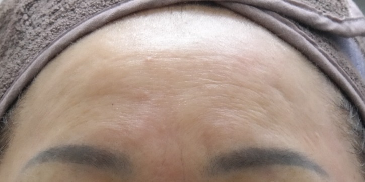이마땡김 전.JPG